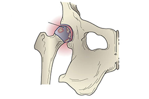 Hip Dysplasia in Dogs